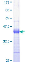 12.5% SDS-PAGE Stained with Coomassie Blue.